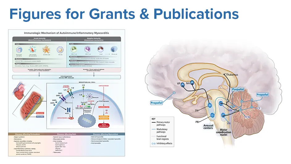 Two scientific diagrams: one showing immunologic mechanisms of myocarditis with labeled pathways and cell types, and another illustrating brain regions affected by propofol with annotated neural pathways.