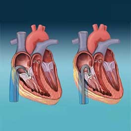 heart showing four chambers