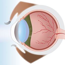 Anatomy of the eye Side view of an eyeball